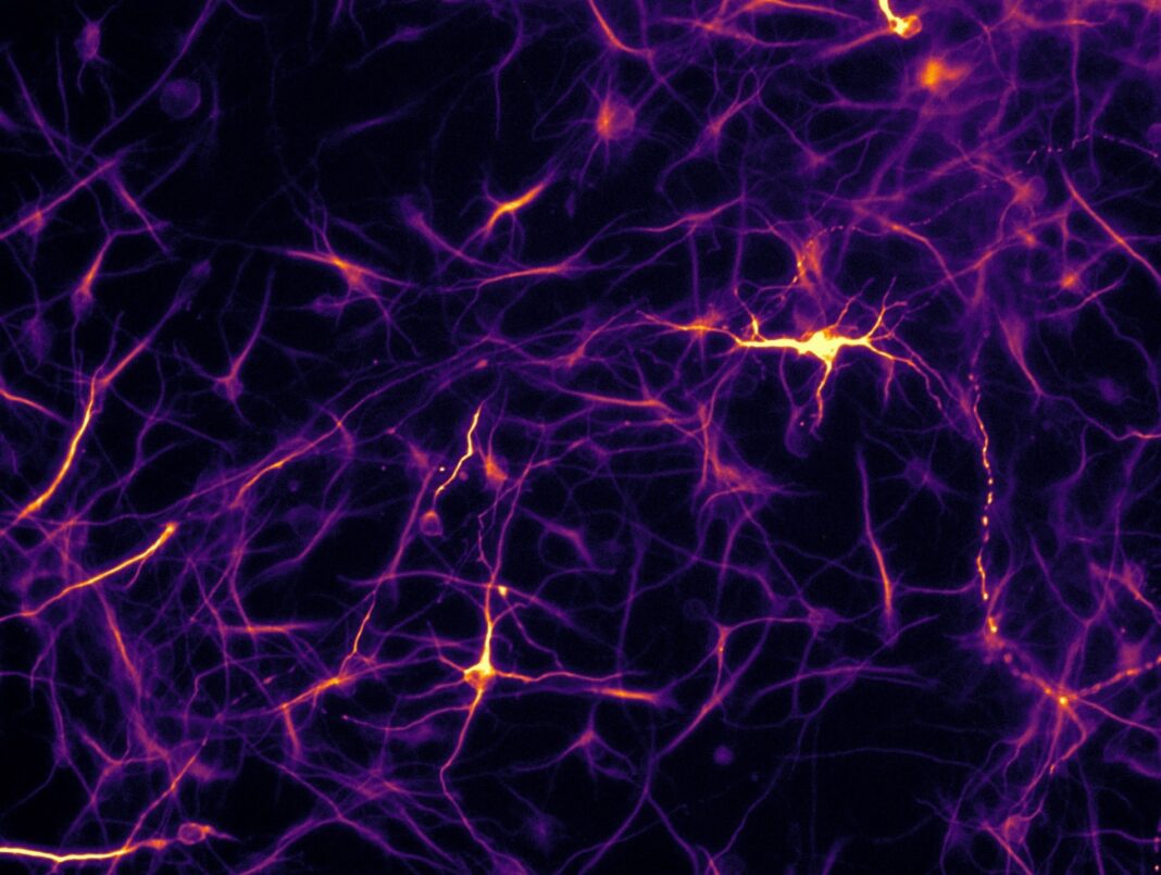 Cellule artificiali per far differenziare i neuroni