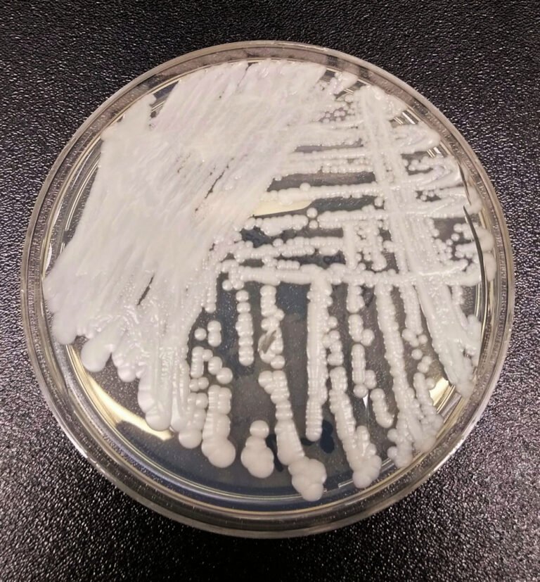 Candida auris: e se la minaccia venisse dai miceti?