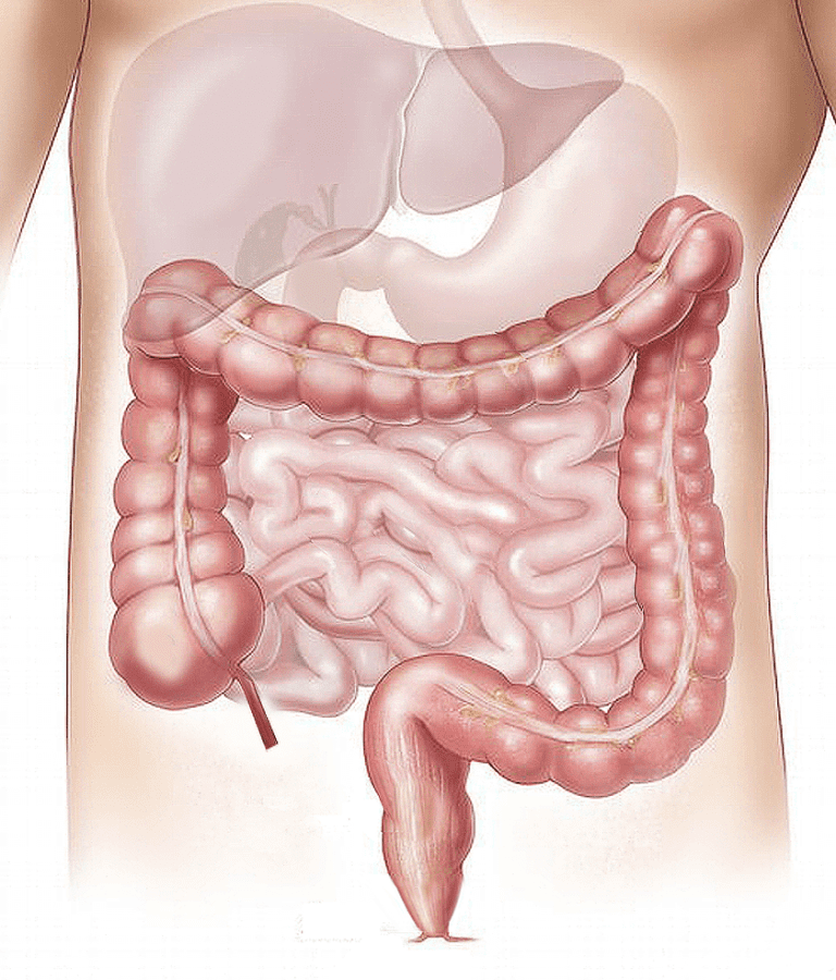 E se i parassiti intestinali dessero una mano alla nostra salute?